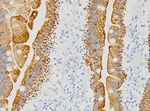 Immunohistochemical Staining microscopic image