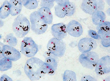 In Situ Hybridization microscopic image