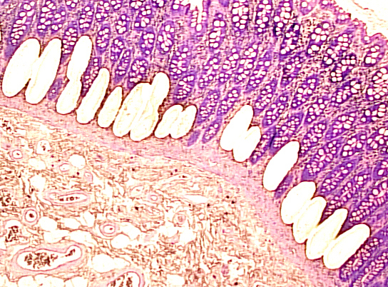 Laser Capture Microdissection microscopic image