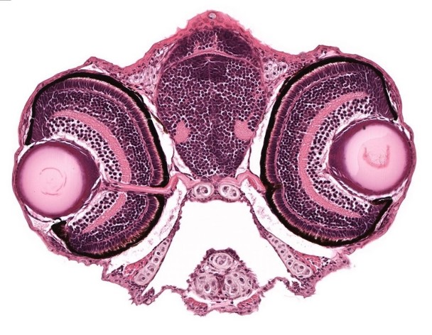 A histological sample is seen, magnified from a slide.