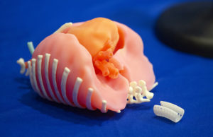 A life-size, colorful 3D printed model of a newborn inner chest area and device against a blue background that was used to plan a tracheal agenesis surgery