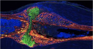 Imaging of fracture callus