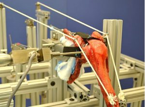 Replacement shoulder being tested in a mechanical machine